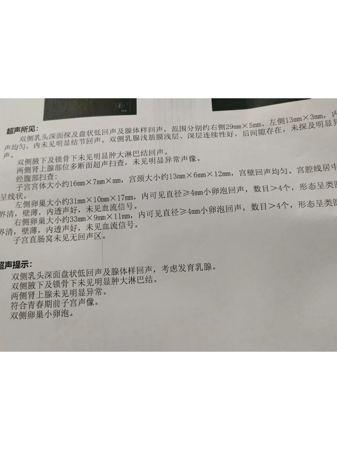 性早熟,代孕第三代试管成功率