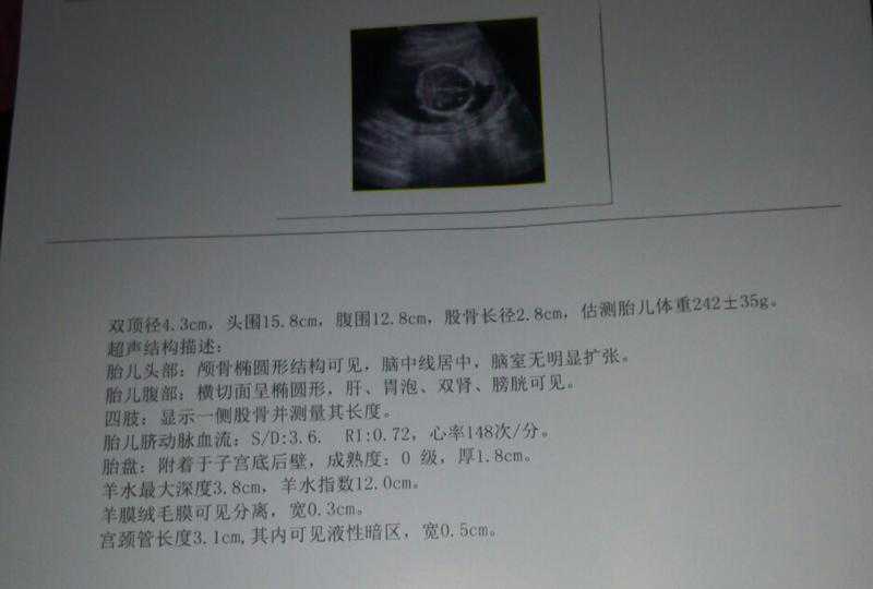 代怀中心包成功&代怀供卵哪家好,中山市试管医院排名比较好是哪家,都有哪些优势